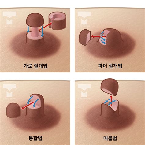 유두 .